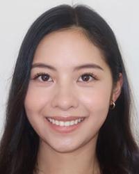 Dr Belinda Luu HBF Dental Joondalup Joondalup