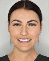 Dr Chelsea R Hirschmann Ooralea Dental Care Mackay