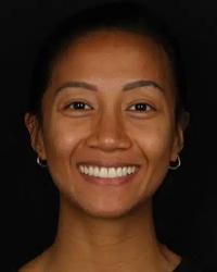 Dr Gladys Tejada Avenue Dental Caloundra Caloundra