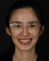 Dr Natalynn Ong Avenue Dental Baringa Baringa