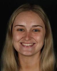 Dr Megan Wydell Avenue Dental Beerwah Beerwah