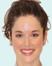 Dr Nikki  Sommers Gentle Dentistry Adelaide Adelaide